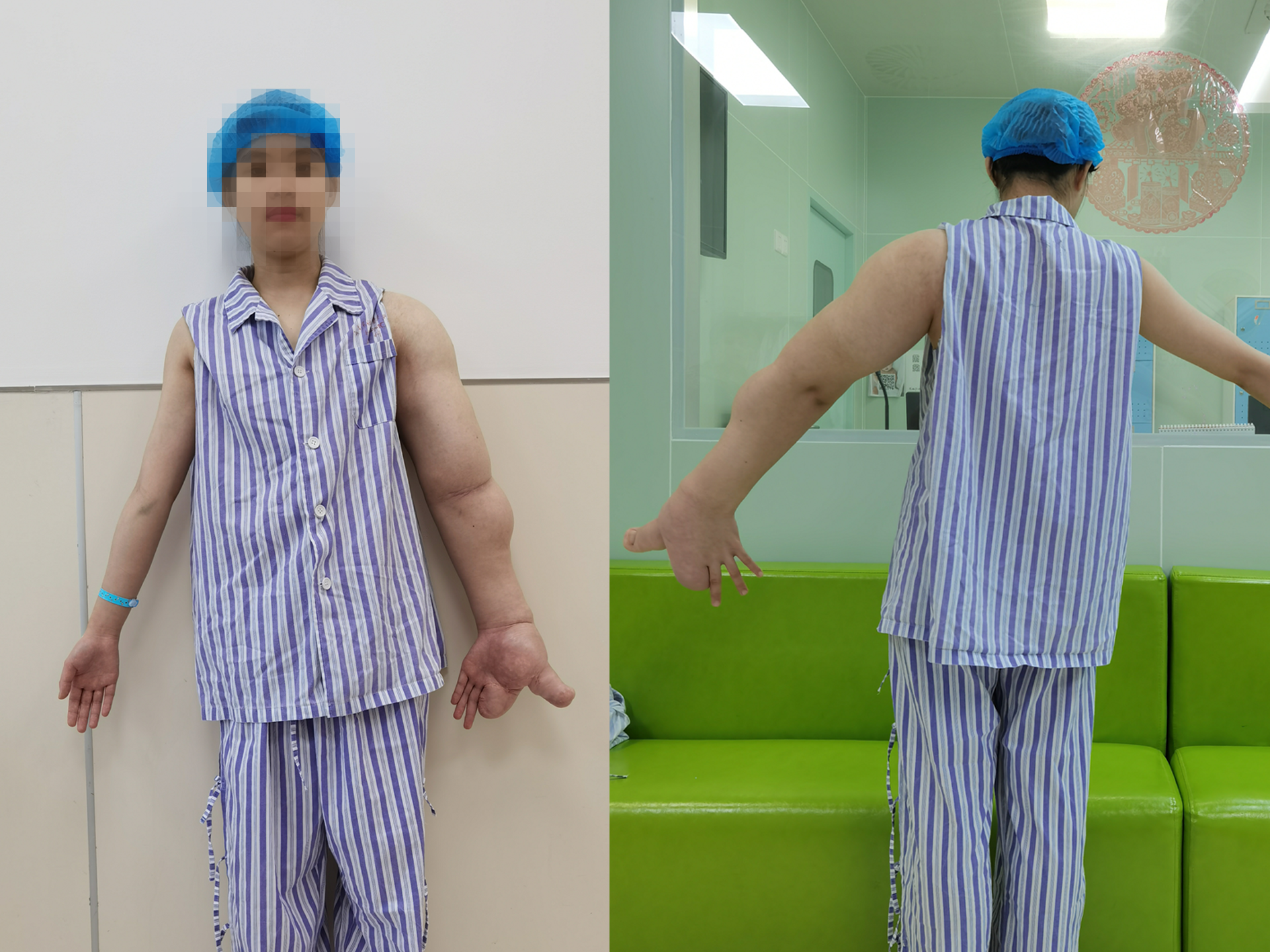 術前正背面組合_副本.png